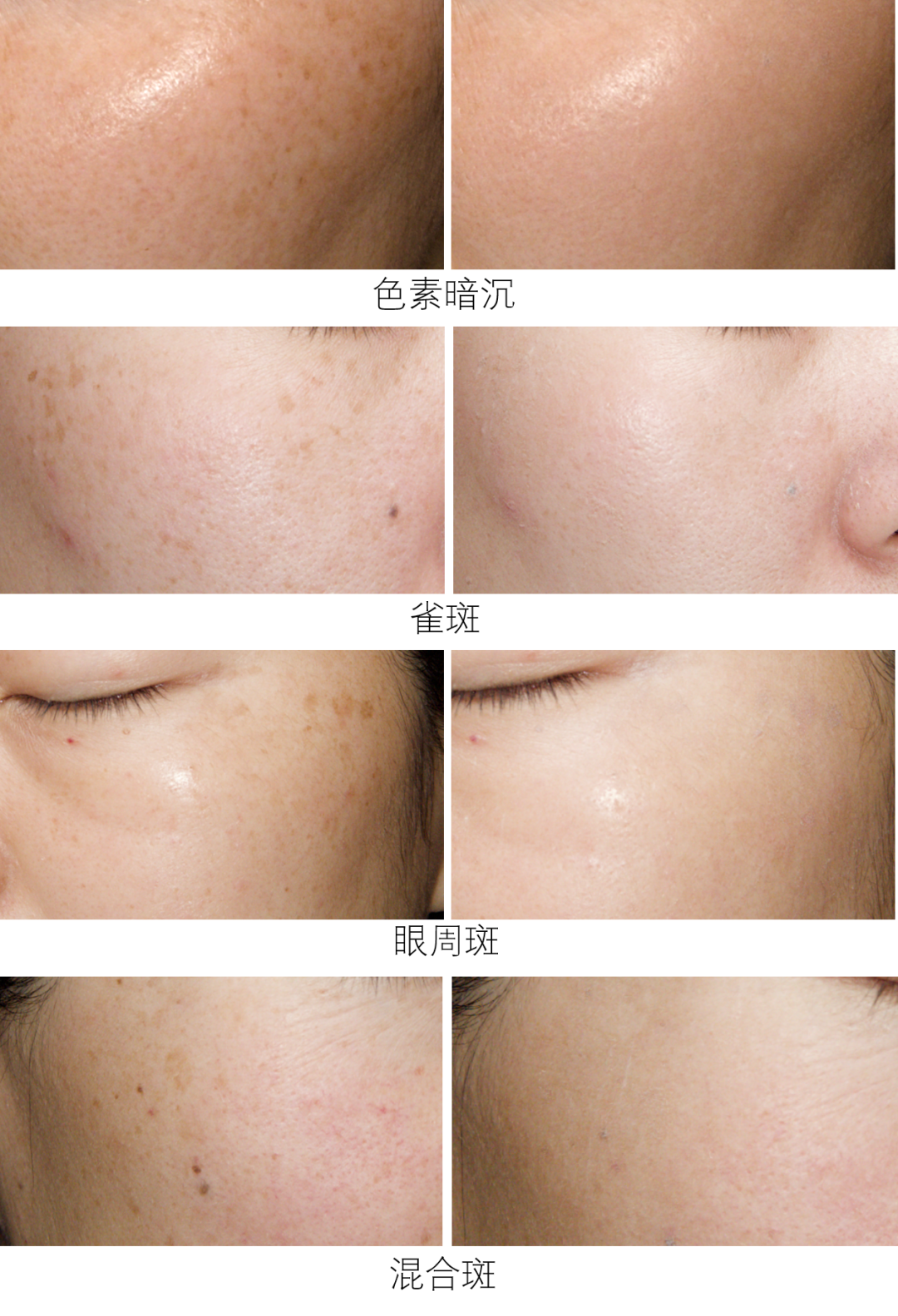 从现在开始，唯诺雅教你不做一“斑”女人