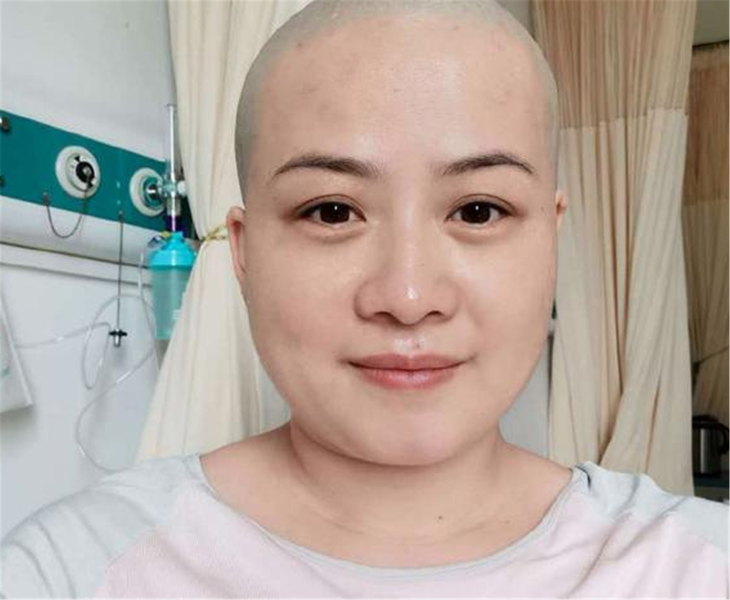 郑敏高情商化解岳云鹏危机，现剃光头住院，岳