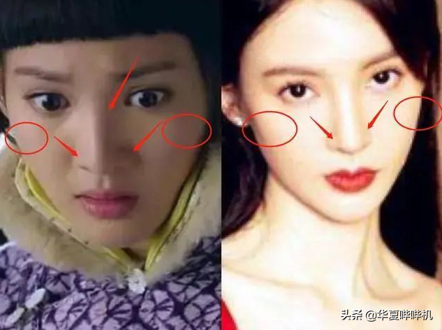 明星大型“翻车”现场，她们是如何整容变毁容