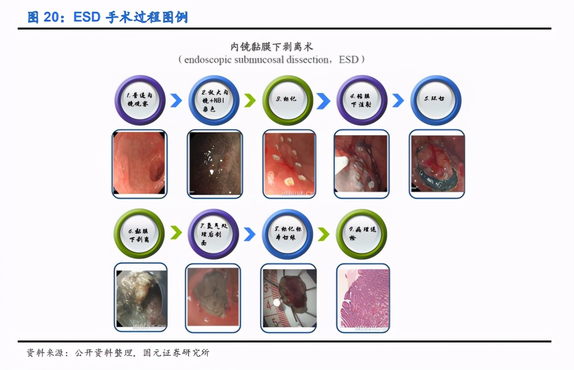 内镜诊疗器械行业深度报告：聚焦高端，着眼全球