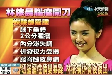 “傻白甜”林依晨的惨淡豪门路，她的故事远比你想象的更恶劣