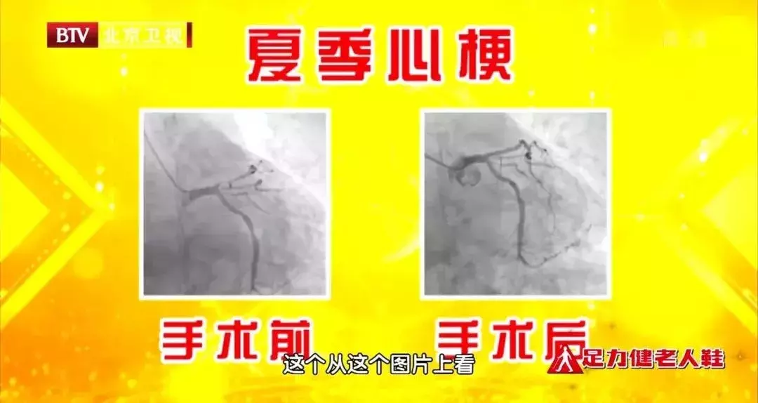 突然心慌、胸闷,当心是缺钾!十大高钾食物排行榜 突然心慌、胸闷,当心是缺钾!十大高钾食物排行榜