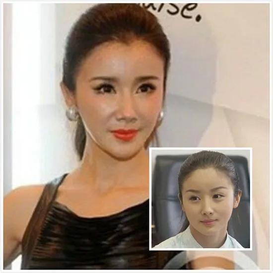 《美人心計》播出11年，10位美人拉開差距，戲外整容遭“毀容”