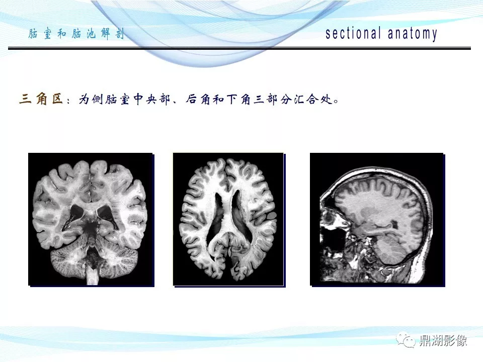 超全详解：脑池和脑室断层解剖