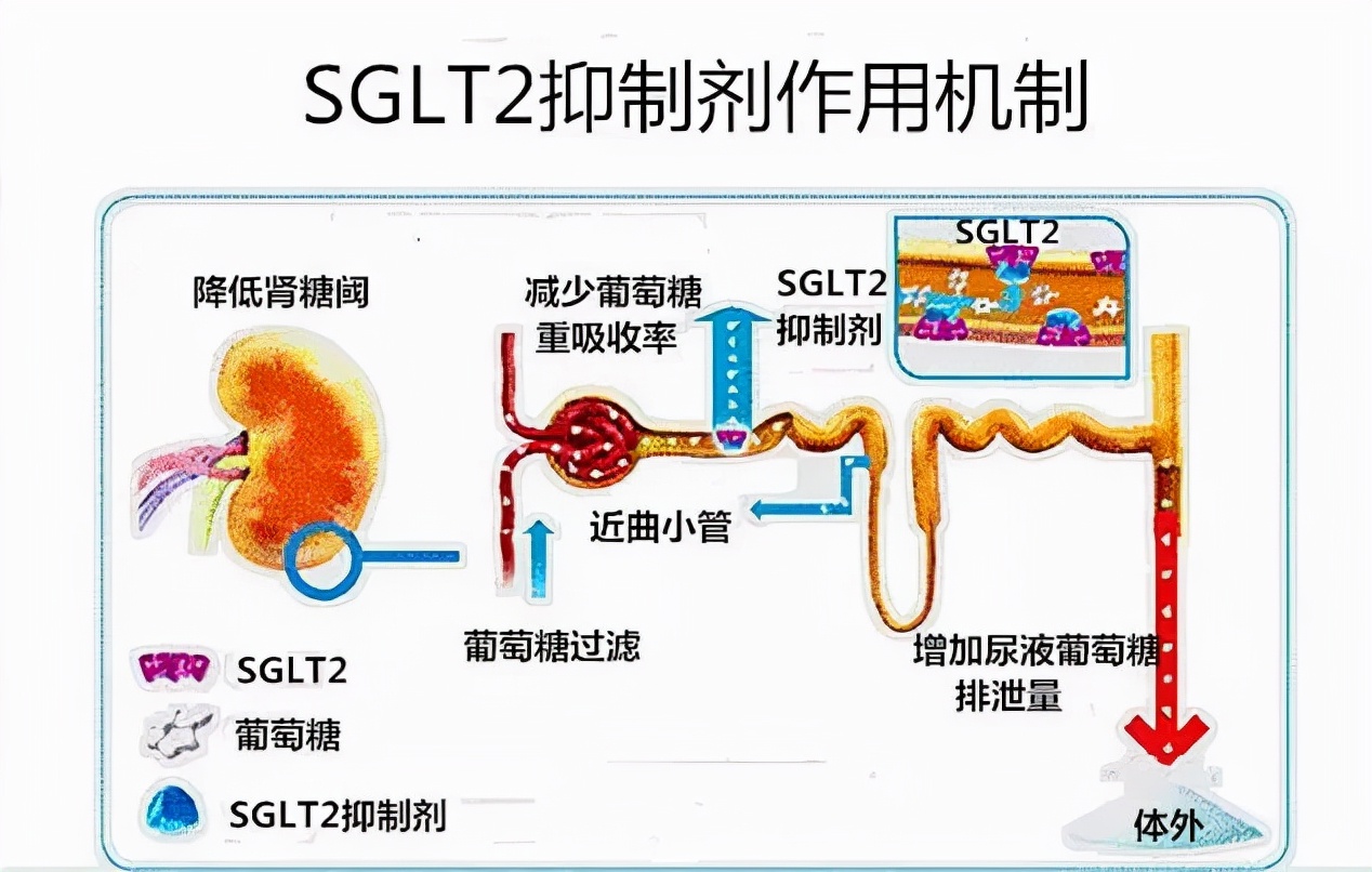 “尿中排糖，心肾双重获益”——SGLT2抑制剂知多少