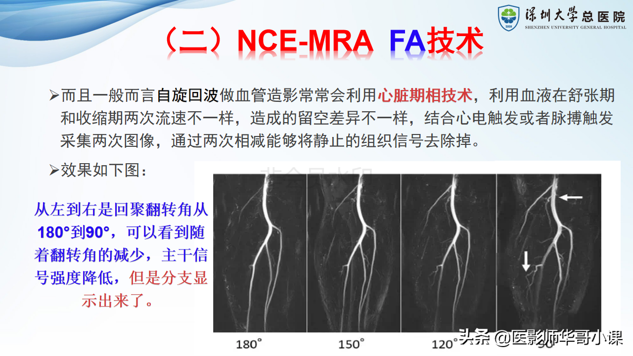 磁共振非增强双下肢血管MRA