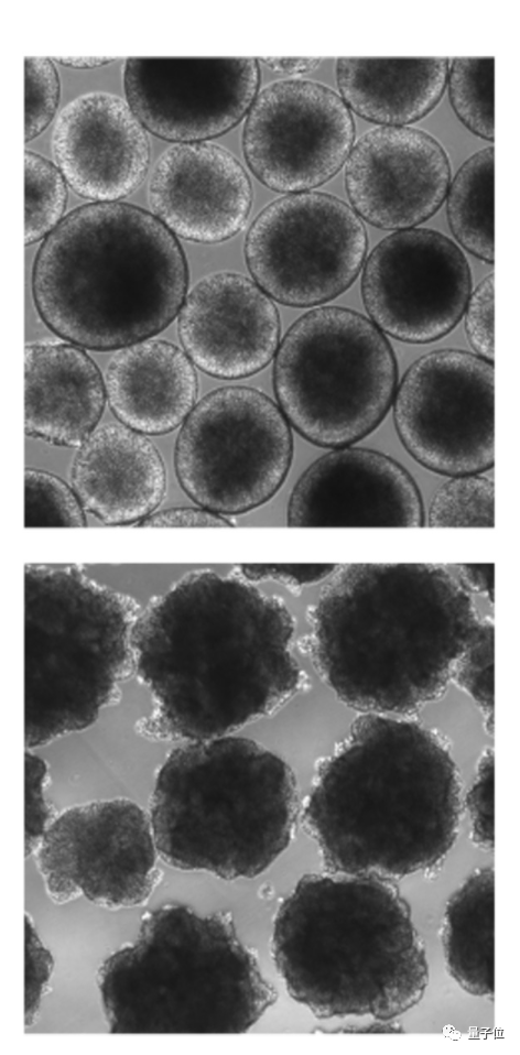 Science：人類在實驗室創(chuàng)建了微型大腦，含祖先基因的那種