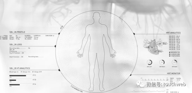 医疗成像企业Nano-X Imaging上市：市值10亿美元