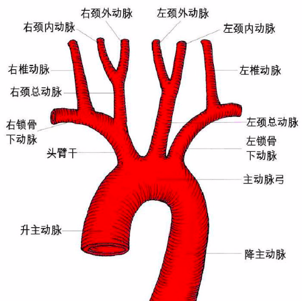 頸動脈的功能是什麼 狹窄後如何治療 心血管病醫生李運濤 Mdeditor