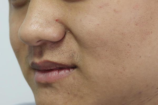 皮膚發黃，是什麼原因？ 皮膚主任建議多吃4種食物，有助祛黃