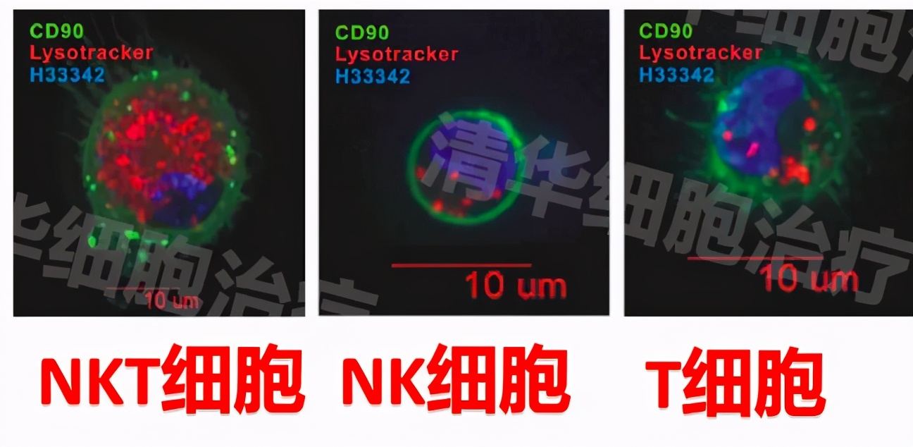 杀死癌细胞的能力，人体免疫细胞中的NKT细胞为何会如此厉害