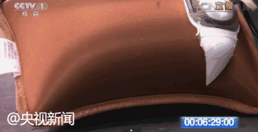 用热水袋暖宝宝取暖，却上了手术台！这类“御寒神器”别买
