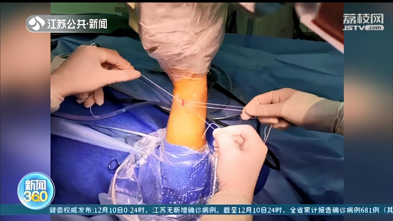 昆明消防员训练中受伤 跨越1700公里南京求医 提醒：别小看扭伤、拉伤