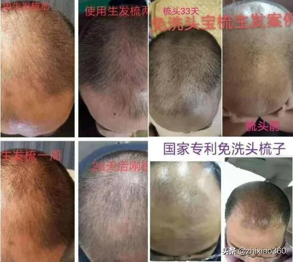 一把梳子能包治百病?涉嫌传销,东施帛关联公司被冻结资金2500万