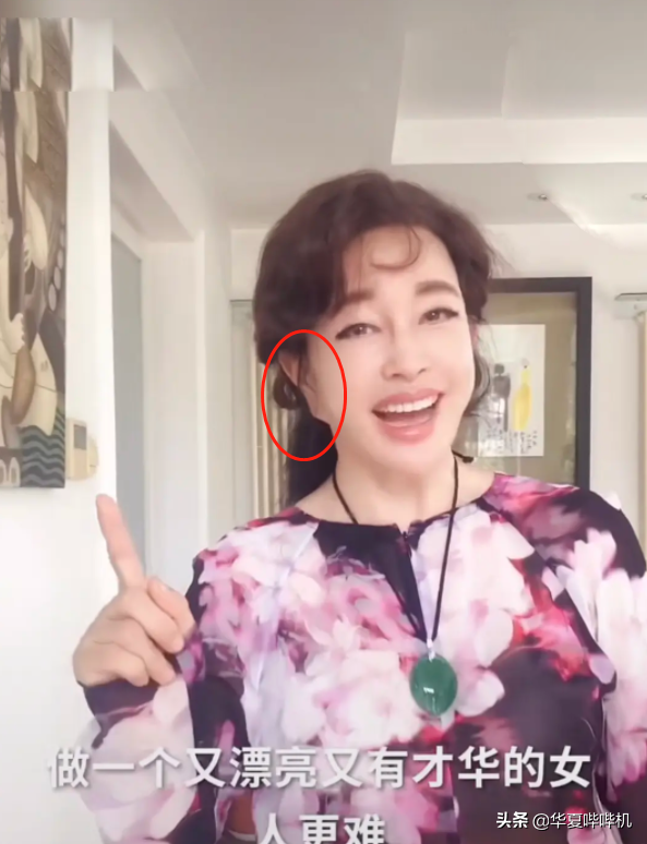 明星大型“翻车”现场，她们是如何整容变毁容