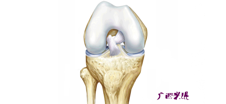 米琨 膝關節軟骨損傷的外科治療 骨科線上 Mdeditor