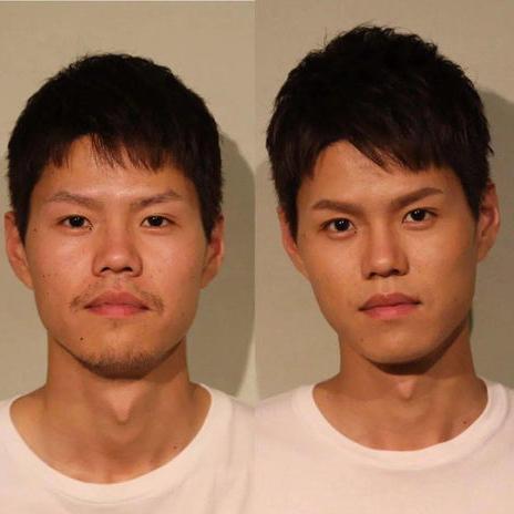 腎臟是否健康，教你4個檢查特徵自查