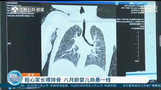 万不可大意！粗心家长喂排骨 八月龄婴儿命悬一线