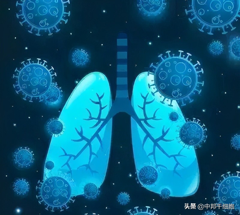 肺纤维化的“清道夫”，肺损伤患者的福音