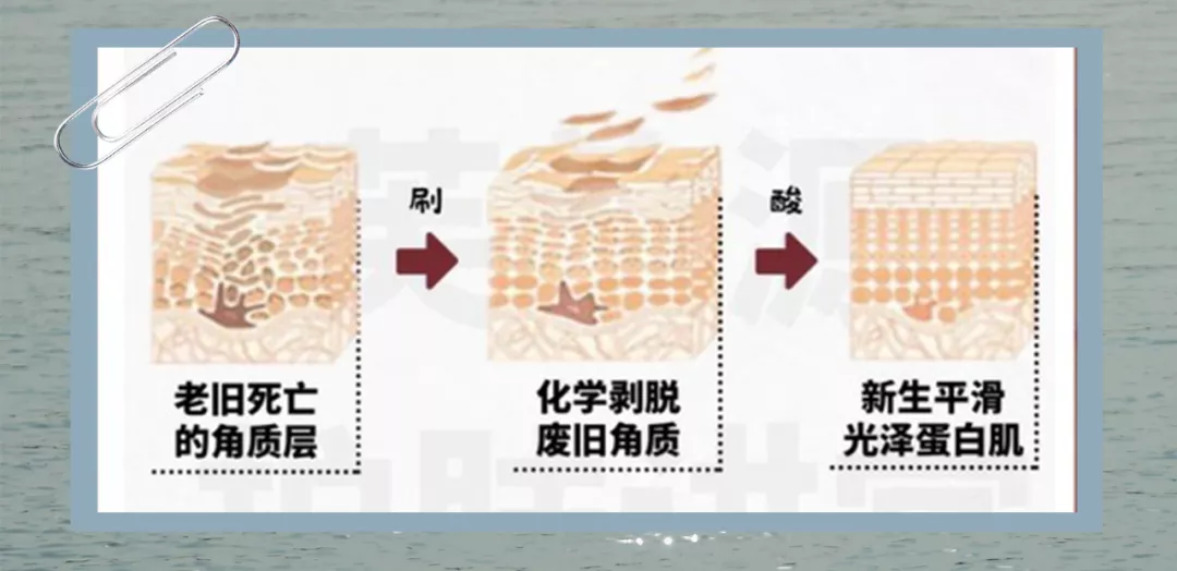 入门级医美项目指南!美容院不告诉你的,这篇全都有