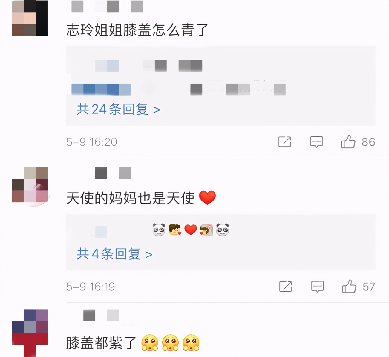 林志玲与妈妈合影，网友被腿上淤青吸引，引发猜测：被老公家暴？