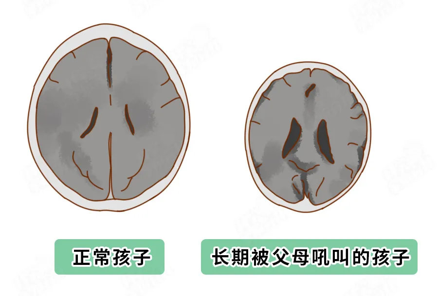 “吼孩子”竟然影响长高，再也不敢了