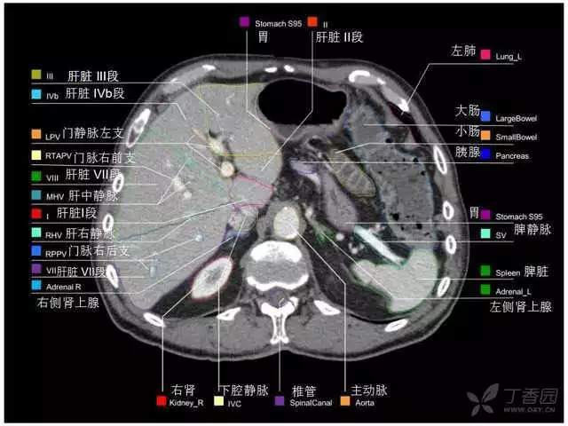 掌握这篇解剖，晋级腹部CT影像诊断高手（精细版）
