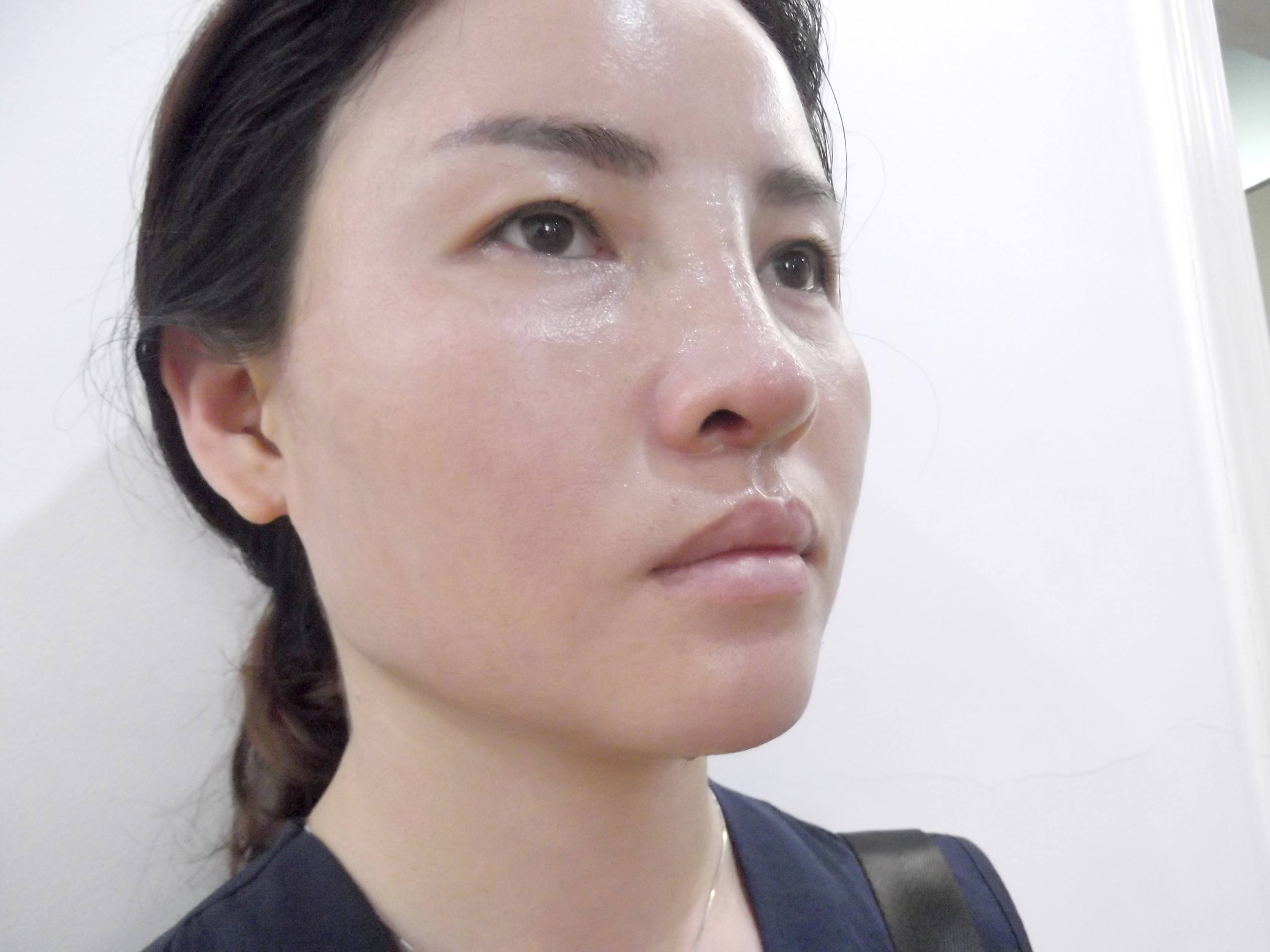 生活中，肝不好的人，眼睛和鼻子有這樣的提示，不知你注意到了沒