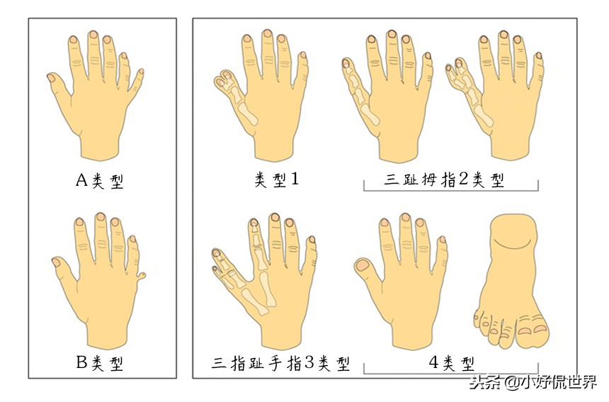 这个世界很多人还未曾听过的21个有趣的事实-第14张图片-大千世界