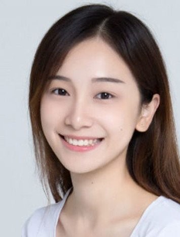 5位瘦成皮包骨的明星，不分男女的减肥，当真要钱不要命？