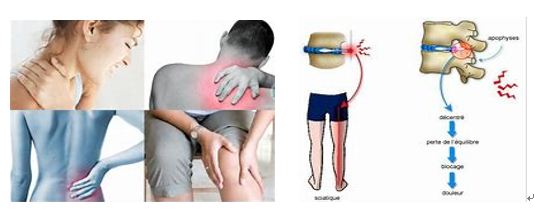 腰腿痛长期服用中成药安全性究竟如何？来看看统计数据