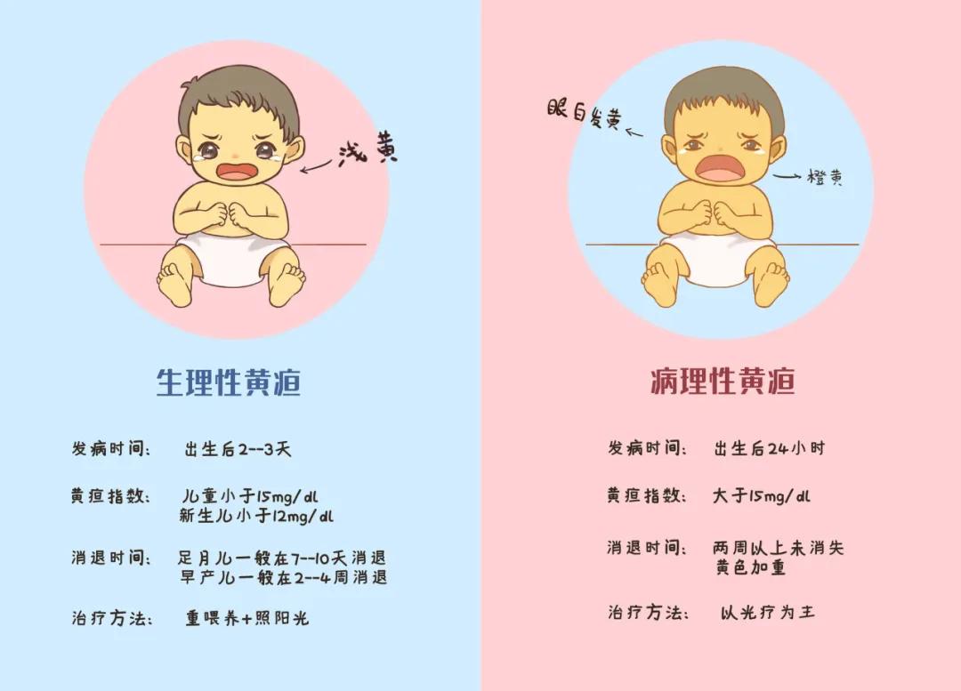 新生儿黄疸护理和治疗攻略
