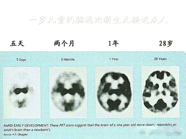 童年失忆症是怎么回事？为什么人类没有3岁前的记忆？