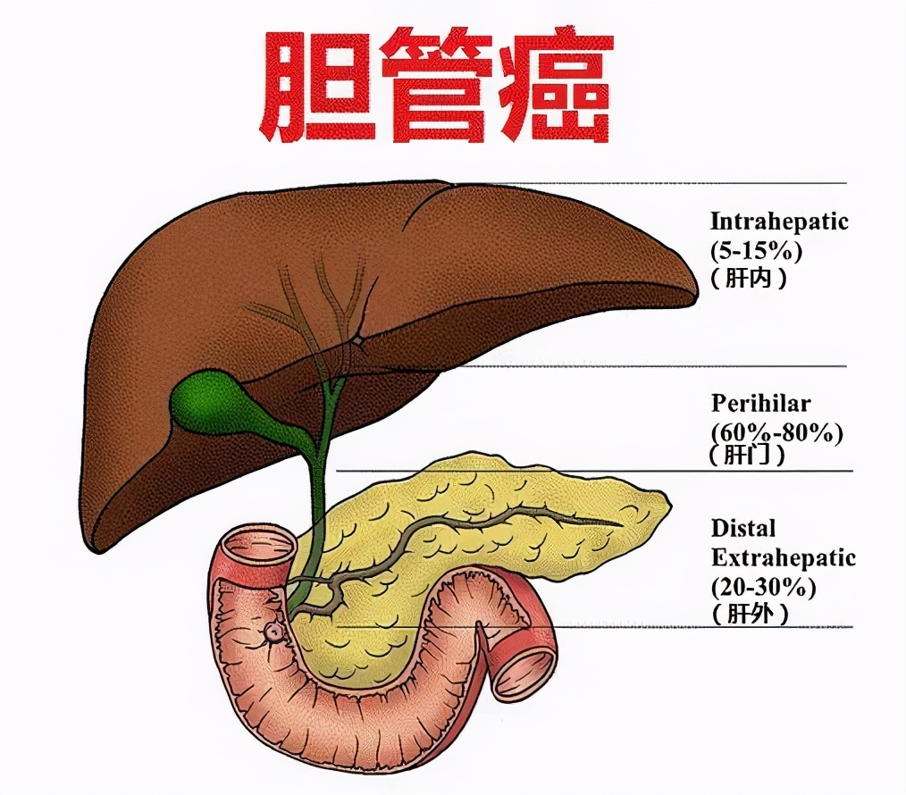 胆管癌靶向新药TAS-120获FDA突破性药物资格认证