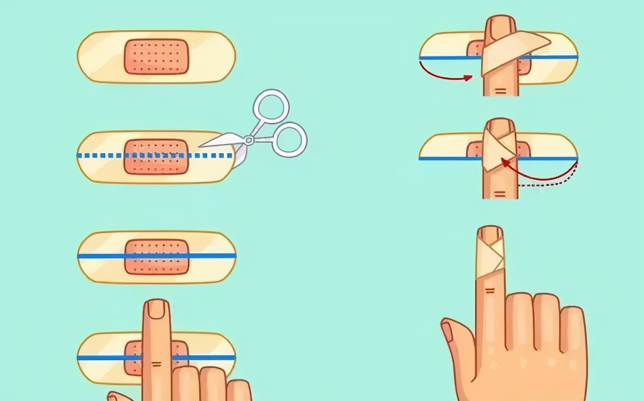 家人错误包扎致3岁女童手指坏死被截肢,正确包扎方式看这里