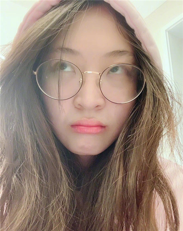 Champion of women's volleyball Olympic Games is a firm person! Husband takes her to unplug 4 wisdom tooth, groan 3 days of faces are done not have swollen