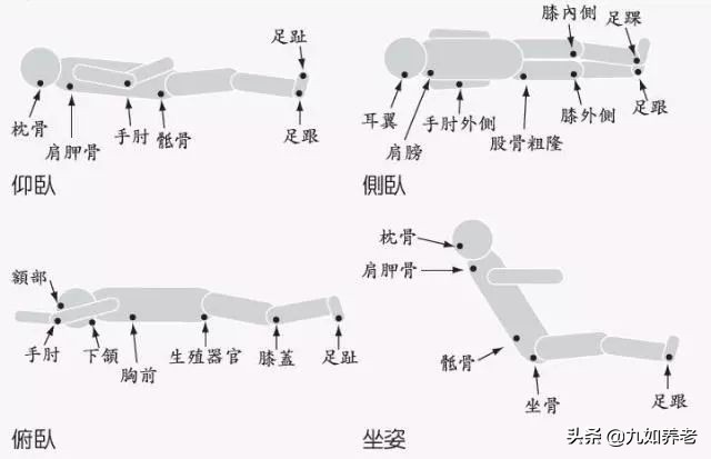 夏季卧床老人如何预防褥疮？日常护理要做好这 5 点-第3张图片-农百科