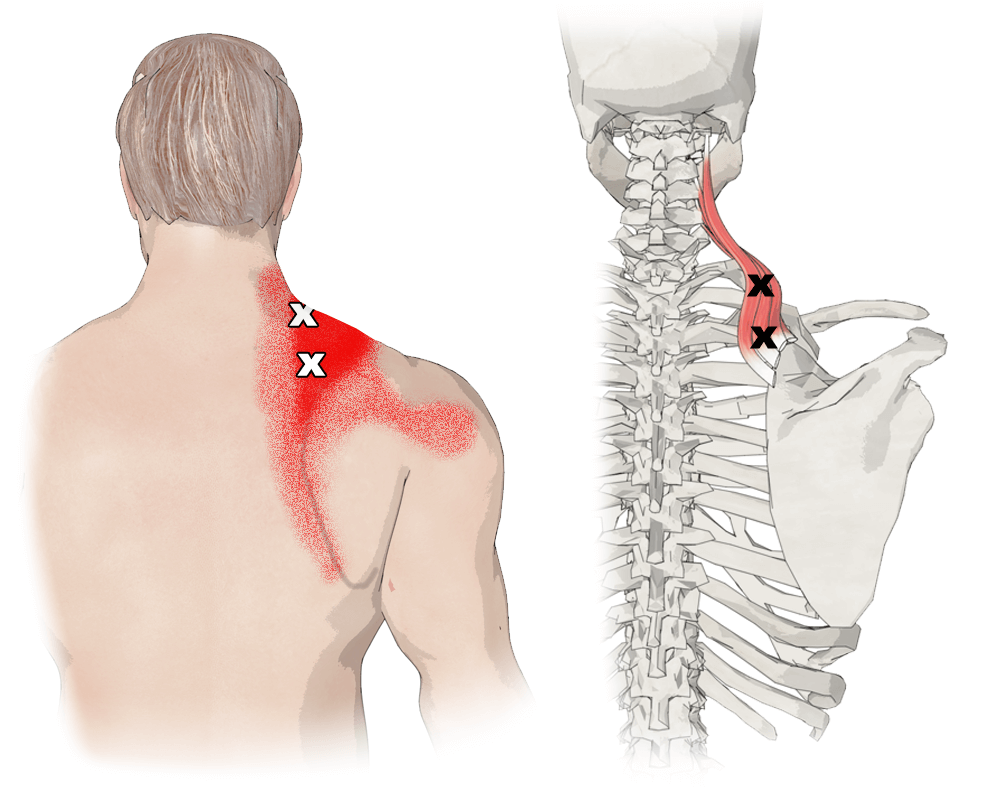肩胛提肌的位置图片图片
