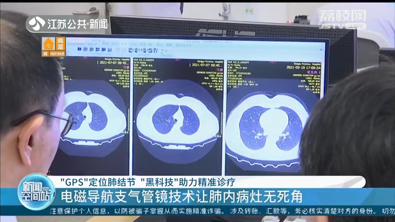 电磁导航定位肺结节，“黑科技”助力精准诊疗