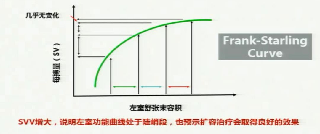 谭宏宇教授：老年冠心病患者的容量治疗