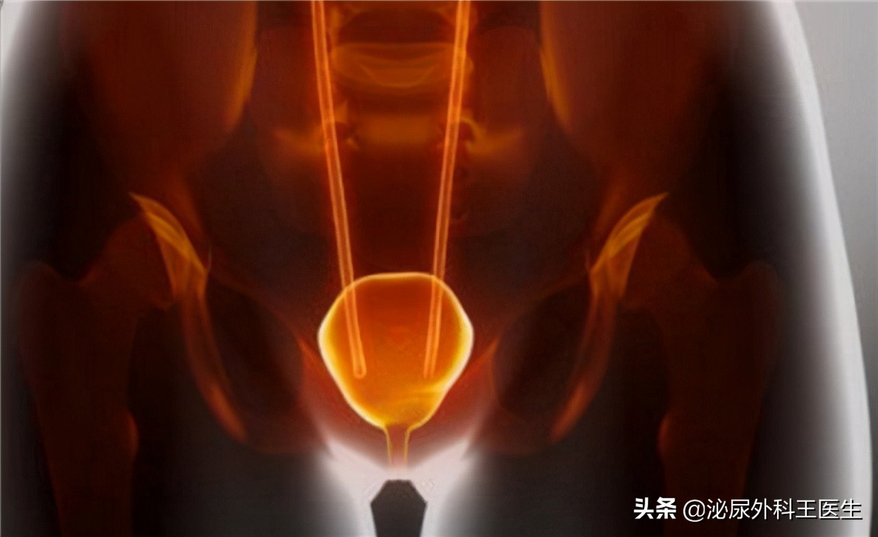 坦索罗辛除了改善尿频，还能治疗良性前列腺增生、早泄等男科疾病