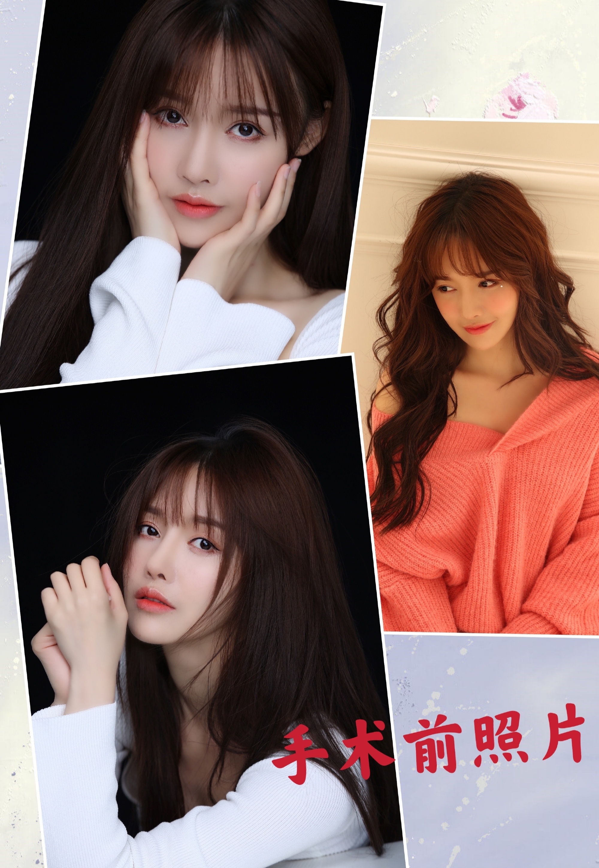 "The actor sneaks away high face-lifting fails, life destroyed " : What she makes is wrong, attended one class to all schoolgirls