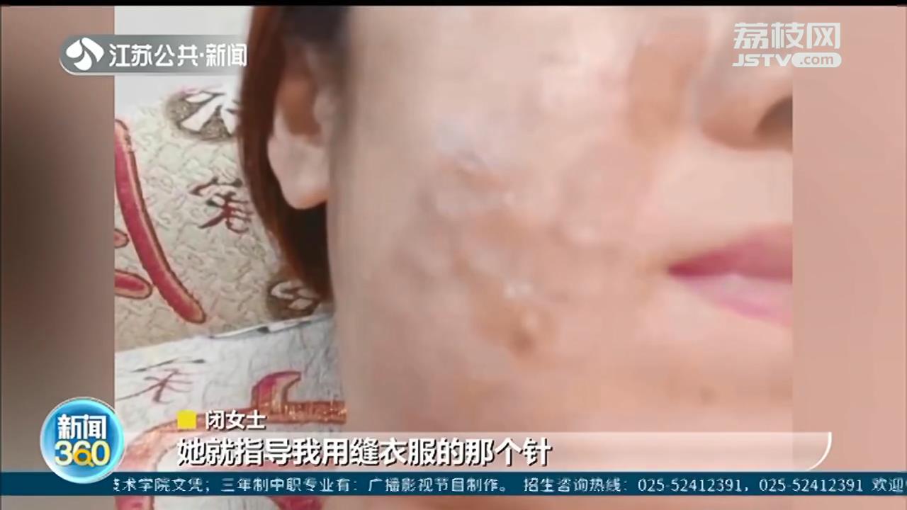 网红美容“热玛吉”频出事 皮肤抗衰老不成反被烫伤