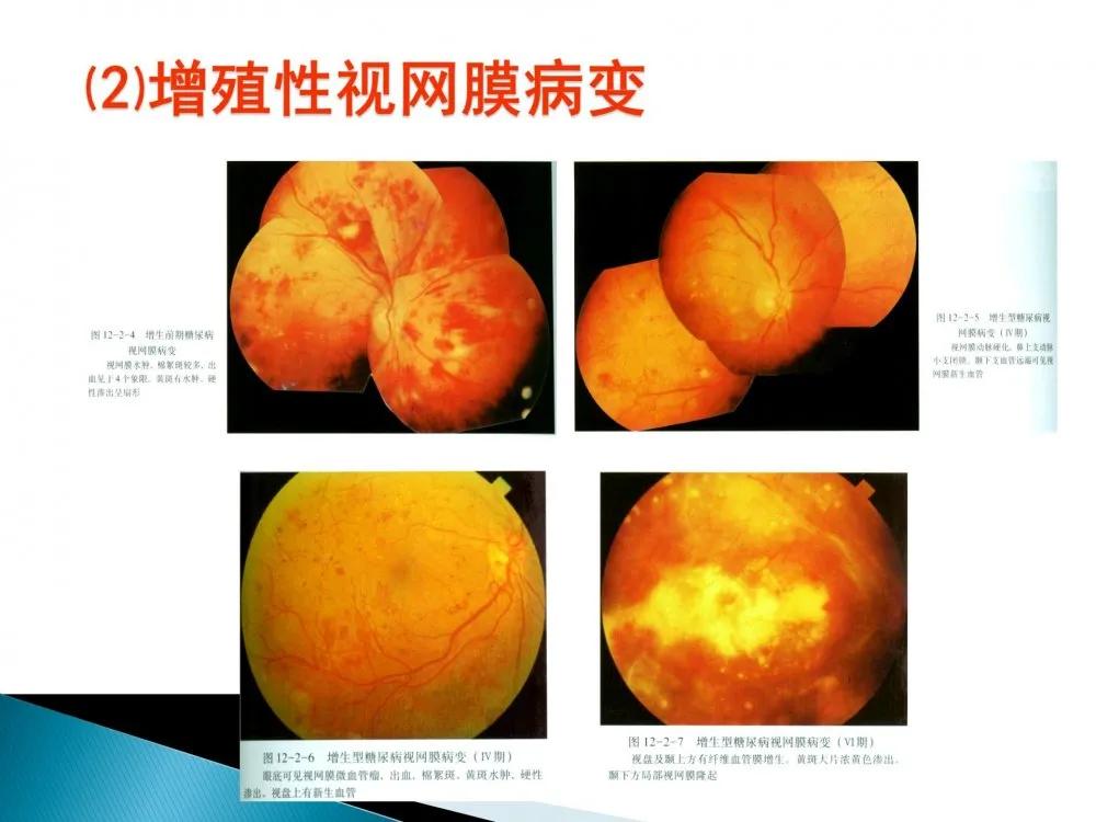 健康科普大赛获奖作品展示⑤|老年人常见眼部不适