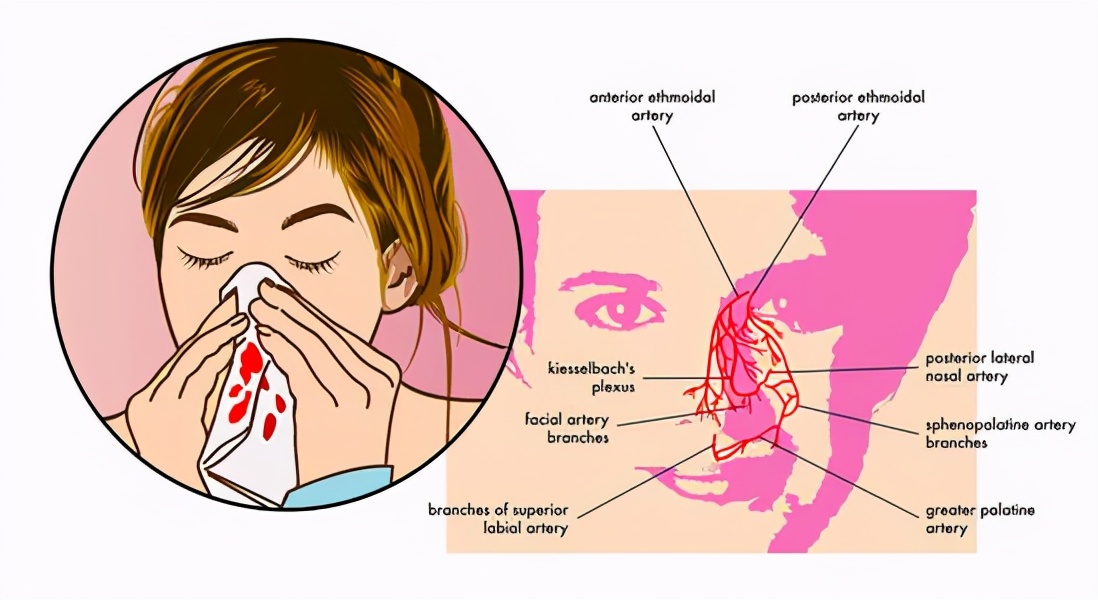 儿童鼻塞与鼻出血的小常识