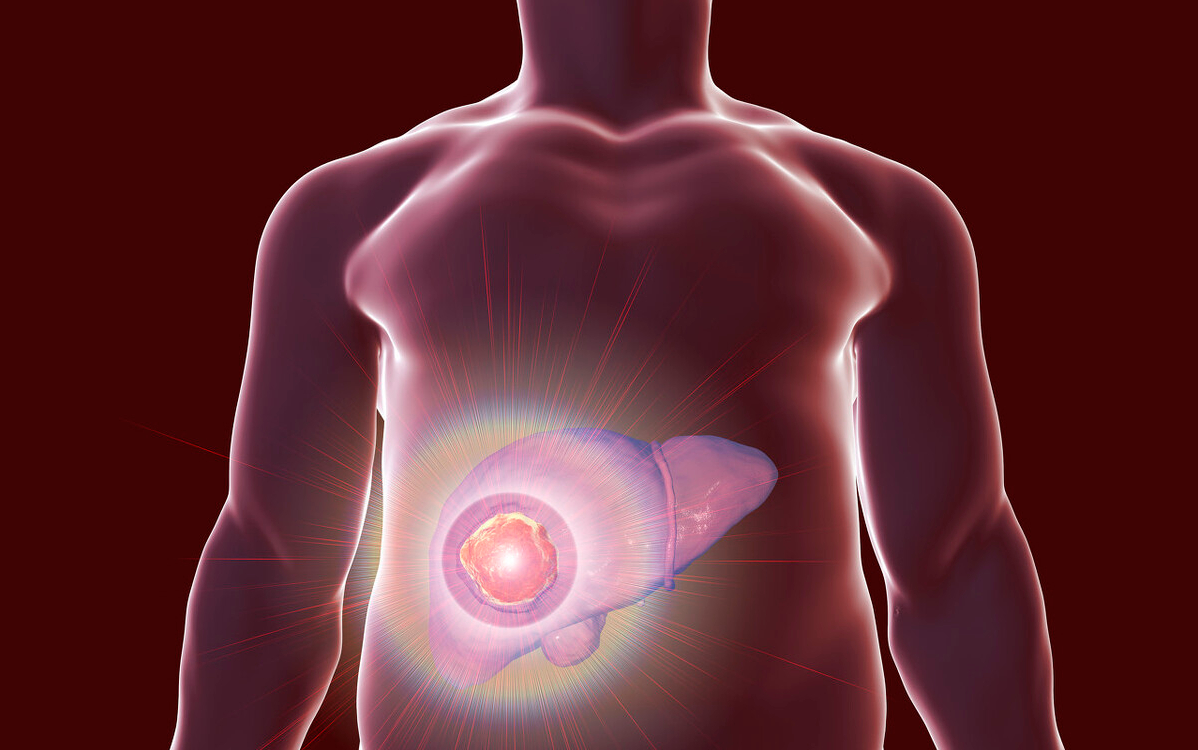 往來寒熱、胸脅苦滿，中藥是用小柴胡湯；那穴位呢？ 醫生為您解讀