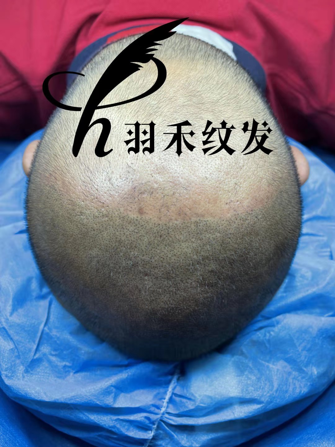 纹发能长头发吗？