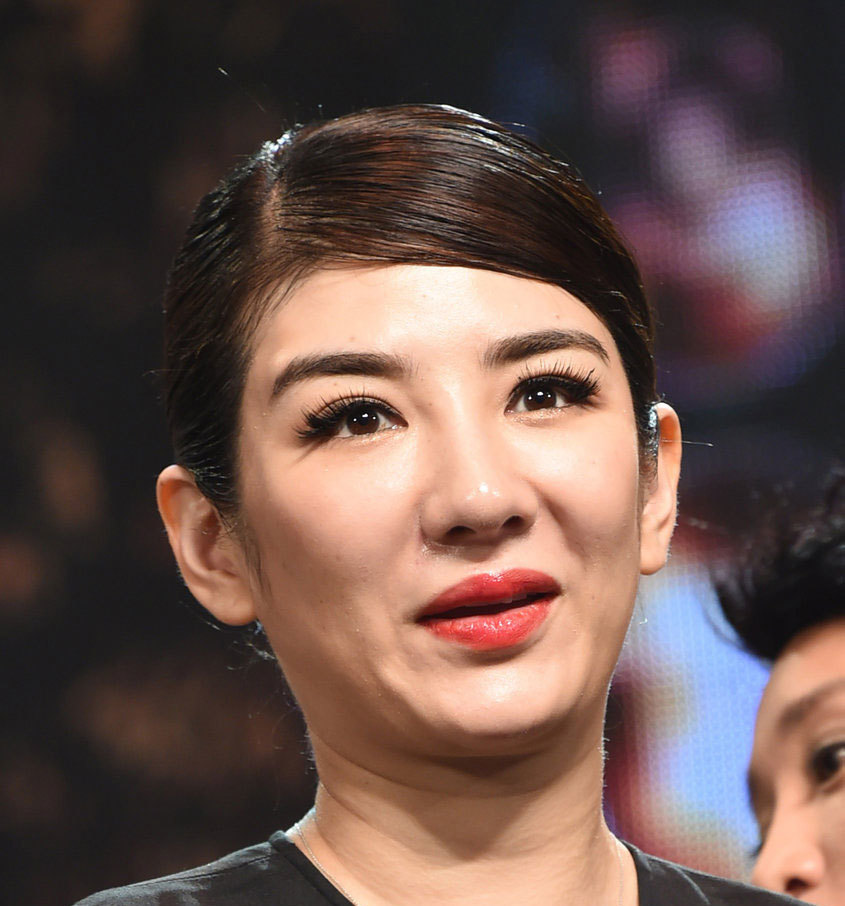 10位“整容上瘾”的女星，明知硅胶脸恐怖，为何还是前仆后继？