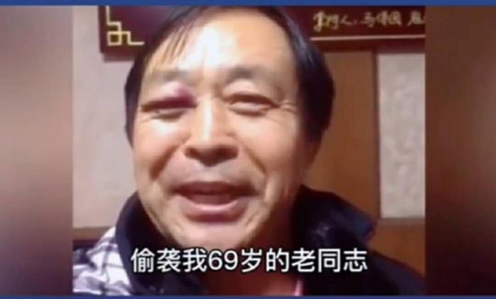 马保国鼻青脸肿还自夸，称自己点到为止，对方无武德偷袭69岁老人