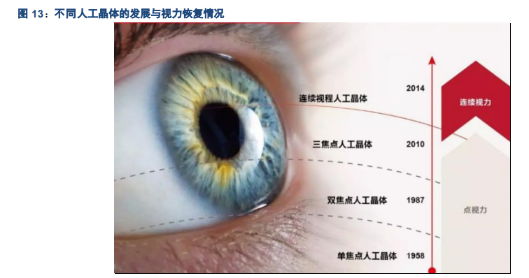 眼科行业研究之人工晶体发展机会专题报告
